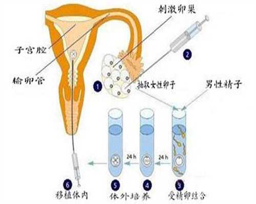河南十月助孕口碑好么?,河南那个医院做试管婴儿最好?
