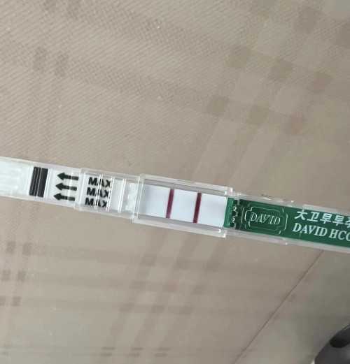 洛阳哪里做试管婴儿好,洛阳做试管婴儿的医院哪里好