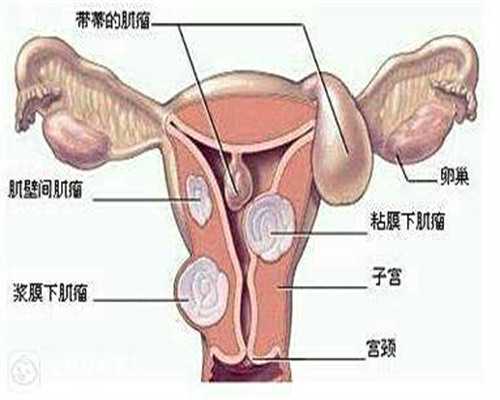 郑州代孕网公司,北京海外辅助生殖机构名单_中信湘雅卢光秀团队有哪些医生