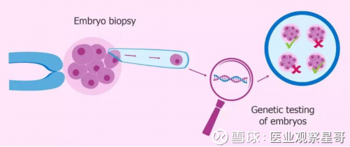 郑州单身男人可以做试管吗 郑州陇海医院 ‘孕妇晚期彩超看男女’
