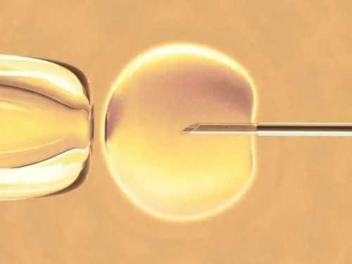 多囊卵巢长期不排卵打促排卵针真的有用吗？