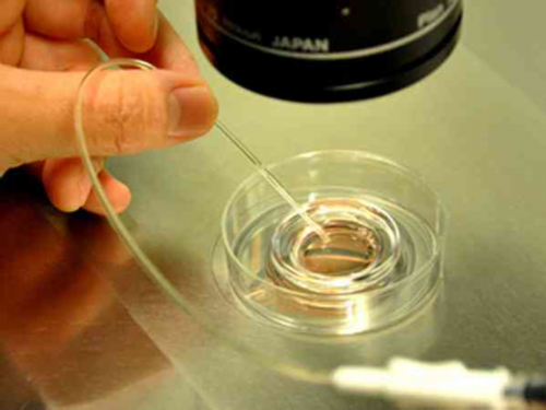 周口第三代试管选性别经历？河南三代试管比较好的医院