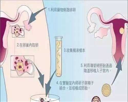 洛阳代孕包成多少钱|2026银川三代试管供卵生孩子费用介绍总体不贵但也不便宜