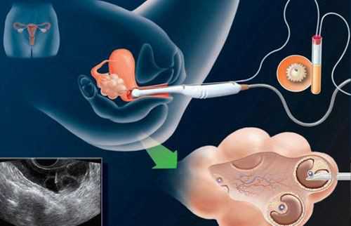 郑州第三代试管婴儿医院成功率排名？附医院明细？