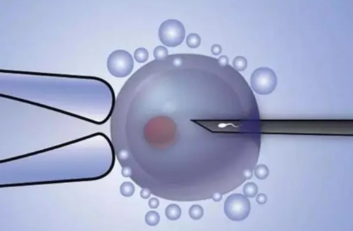 河南三代试管医院排名附部分医院指南[河南试管医院]