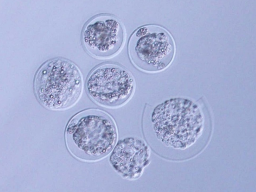 河南省试管婴儿医院排行前5的有哪些