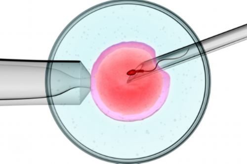 郑州人民医院郑州人民医院试管婴儿怎么样