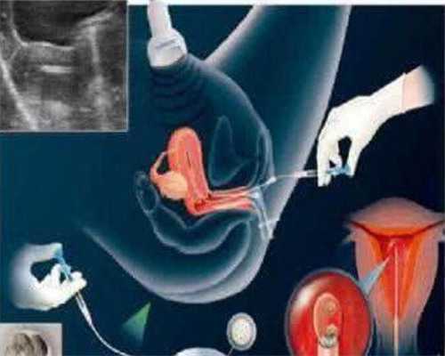 代怀代生孕_哪些人可以代怀_多囊卵巢备孕2年无果,在卫辉市能做试管婴儿吗?