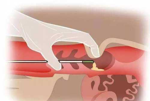 洛阳市妇幼保健院首例试管婴儿顺利诞生！,洛阳市妇幼保健院试管婴儿费用表