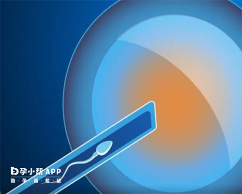 郑州哪里能治好不孕不育