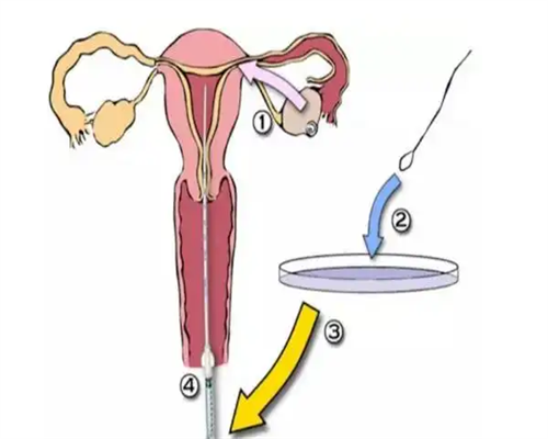 洛阳有泰国试管婴儿公司吗？,洛阳泰东方试管婴儿公司怎么样