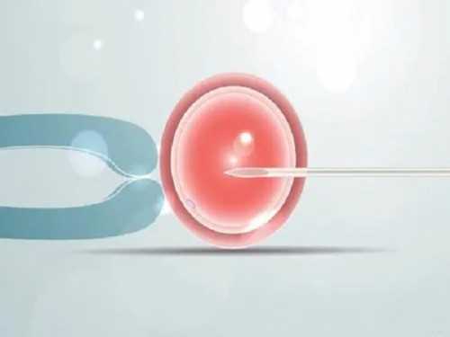 河南新乡试管婴儿