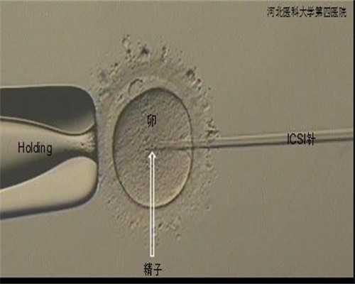 洛阳植发哪家医院好？洛阳鹏程医院口碑测评+植发价格