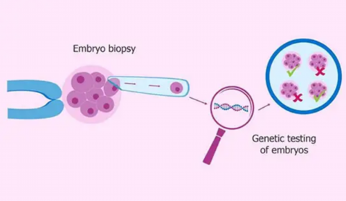 洛阳试管婴儿成功率高吗,2026洛阳协和医院有卵子库吗?