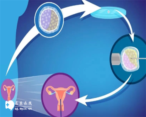 洛阳哪里可以做试管：洛阳试管三代详细流程