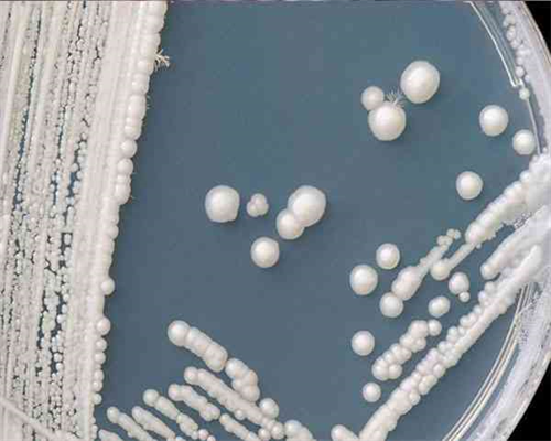 代怀网哪家好_代怀机构哪家好_广东地贫筛查是免费的还是自费的？