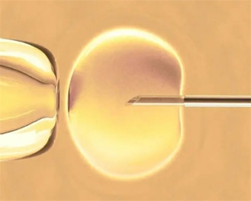 辽阳供卵代怀孕三代试管包儿子