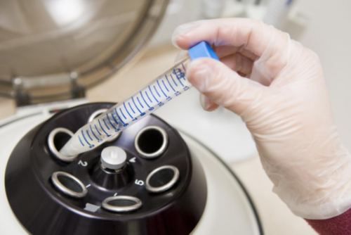 2026漯河市第一人民医院做试管婴儿可以筛查胚胎性别吗?附河南三代试管医院