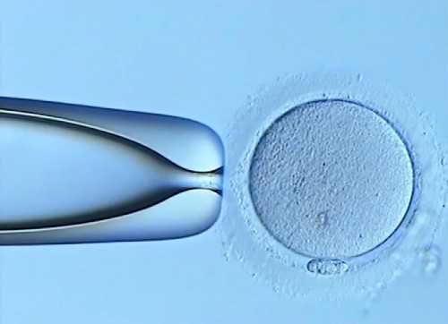 河南三代试管中介价格 河南人民医院供精试管流程： ‘nt孩子倒立看男女’