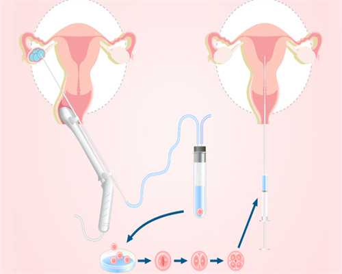 帮别人代怀多少钱_代怀_[延安试管婴儿]试管婴儿促排卵会影响试管婴儿质量吗