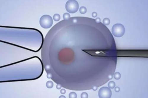 代怀生孩子男孩_何时有合法代怀_瑞白上午打还是下午打好？