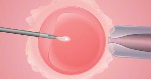 洛阳做试管代怀的禁忌|试管婴儿前期检查到移植需要 血清碱性磷酸酶异常后果