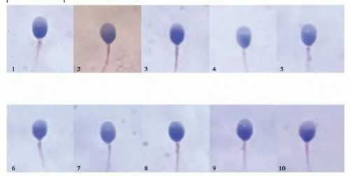 河南哪里供卵公司 河南省试管三代助孕生男孩机构名单更新 ‘37周做彩超怎么