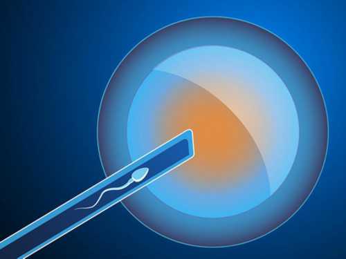 郑州做第三代试管包生男孩价格多少？包生男孩可信吗？