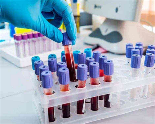 权威代怀网_代怀哪家专业_多囊卵巢综合征做泰国试管婴儿注意事项