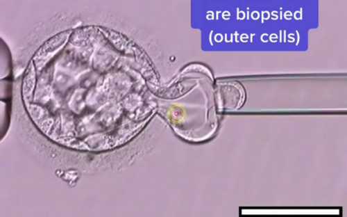 洛阳北大试管的流程费用一览,2026
北大洛阳医院试管婴儿费用明细分享，三代供