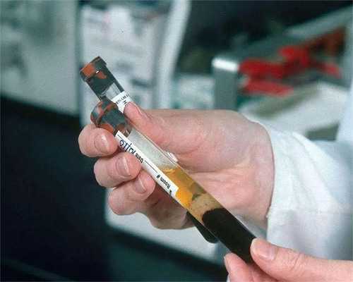 代怀孩子哪里有_找女人代怀_云南省第一人民医院三代试管婴儿生男孩可以吗？