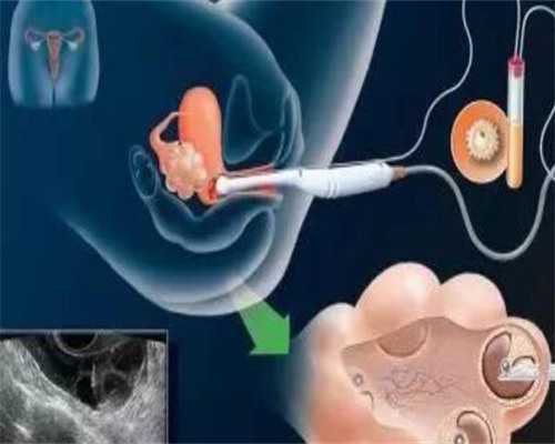 郑州做一次试管婴儿多少钱啊