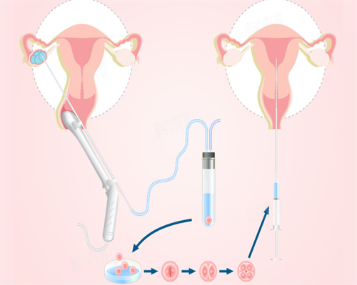 河南正规供卵要多少钱一次呢,河南供卵机构郑州正规医院供卵