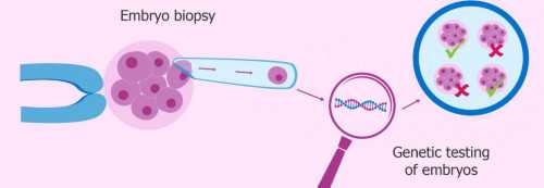郑州找人代生孩吧 孕6个月用地奈德畸形,郑州怀孕一个多月可以检查胎儿性别吗