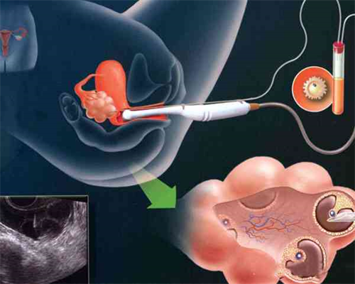河南借卵子费用高吗 河南周口中心医院生殖科哪个专家医生看的好？ ‘四维单