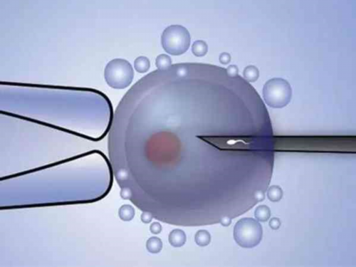 辽阳供卵代怀孕三代试管包儿子