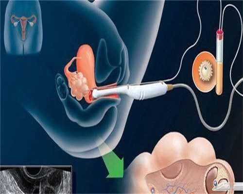 代怀孩子哪家优惠_代怀公司合法吗,去柬埔寨试管婴儿过程中取多少卵子更加容