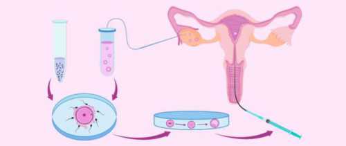 郑州供卵公司费用,郑州三代试管技术排名比较好的医院是哪个