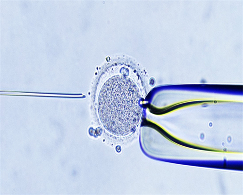 河南省做三代试管的费用,河南单周期试管费用明细