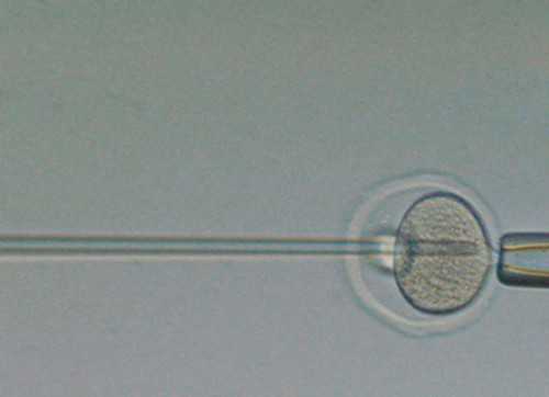 河南三代试管医院排名怎么样？河南三代试管去哪做？