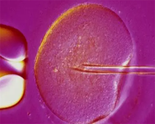 郑州代孕生殖专家,2026
年福建三代试管婴儿私立医院该怎么选？备孕妈妈必看！