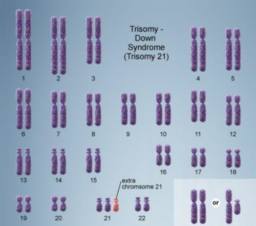 洛阳本土代孕价格|患有梗阻性无精症可以做试管婴儿吗试管婴儿着床